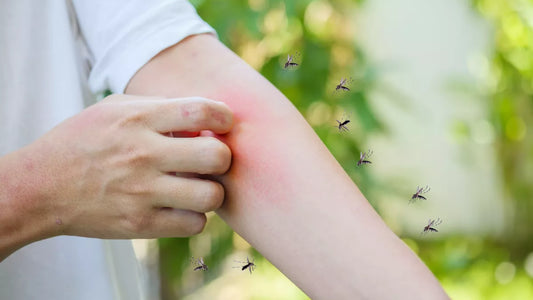 Moustiques et allergies : Comment gérer les réactions allergiques aux piqûres de moustiques
